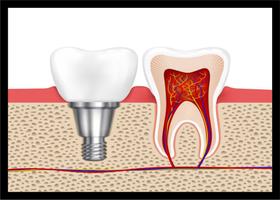 Quadro Decorativo Dentista Consultórios Odontológicos Dentes Implantes Com Moldura RC021 Quadro Decorativo Dentista Consultórios Odontológicos Dentes Implantes Com Moldura RC021
