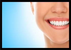 Quadro Decorativo Dentista Consultórios Odontológicos Sorriso Dentes Com Moldura RC017