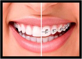 Quadro Decorativo Dentista Consultórios Odontológicos Sorriso Dentes Com Moldura RC062