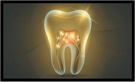 Quadro Decorativo Dentista Dente Dourado Abstrato Odontologia Consultórios Salas Com Moldura RC027 - Vital Printer