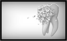 Quadro Decorativo Dentista Dente Humor Abstrato Odontologia Consultórios Salas Com Moldura RC019
