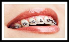 Quadro Decorativo Dentista Dentes Aparelho Dentário Odontologia Consultórios Salas Com Moldura RC018