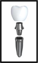 Quadro Decorativo Dentista Implantes Dentes Odontologia Consultórios Salas Com Moldura RC008