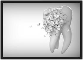 Quadro Decorativo Dentista Odontologia Consultórios Dente Com Moldura Quadro Decorativo Dentista Odontologia Consultórios Dente Com Moldura