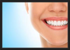 Quadro Decorativo Dentista Odontologia Consultórios Dentes Sorriso Com Moldura