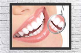 Quadro Decorativo Dentista Odontologia Dentes Consultórios Salas Decorações Com Moldura Quadro Decorativo Dentista Odontologia Dentes Consultórios Salas Decorações Com Moldura