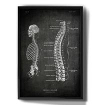 Quadro Decorativo Esqueleto Anatomia Coluna Desenho