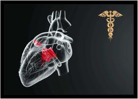 Quadro Decorativo Medicina Cardiologia Bastão De Esculápio Asclépio Com Moldura RC058 Quadro Decorativo Medicina Cardiologia Bastão De Esculápio Asclépio Com Moldura RC058