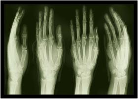 Quadro Decorativo Medicina Radiografia Raio X Consultórios Com Moldura RC010