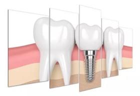 Quadro Decorativo Painel Consultório Odontologia"