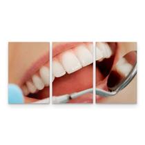 Quadro Decorativo Sorriso Dentista Kit 3 peças Grande ou Pequeno