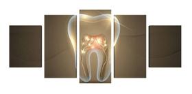 Quadro Mosaico Par Sala 5 Partes Consultorio Dentista