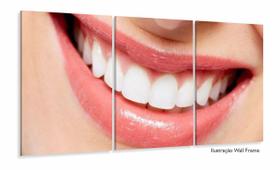 Quadro Odontologia Decorativo Consultório Sorriso 120x60 3 peças Quadro Odontologia Decorativo Consultório Sorriso 120x60 3 peças