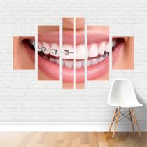 Quadro Profissões Odontologia Dentista Aparelho Dentário Canvas