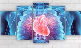 Quadros Para Sala Clinica Médica Cardiolog"