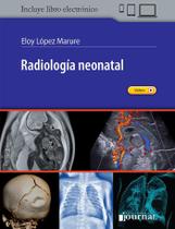 Radiologia neonatal (espanhol) - EDICIONES JOURNAL SA