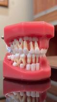 Rd-031 pediatria 5 anos dentição decídua hemi-arco c/ gengiva aberta rosa rígido Rd-031 pediatria 5 anos dentição decídua hemi-arco c/ gengiva aberta rosa rígido