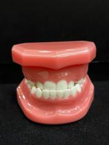 RD-043 Modelo Pediatria Dentição Mista Classe III