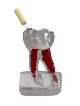 Re-113 macro dente (36) com raiz, endodontia e lima esc. 1x 5 Re-113 macro dente (36) com raiz, endodontia e lima esc. 1x 5