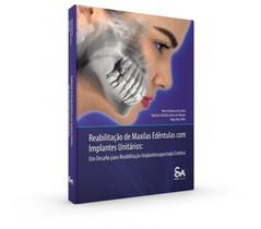 Reabilitação De Maxilas Edêntulas Com Implantes Unitários: Um Desafio Para Reabilitação Implantossuportada Estética - Santos Publicações