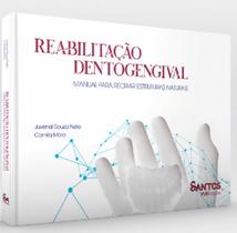 Reabilitação Dentogengival - Manual para Recriar Estruturas Naturais - Santos Publicações