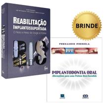 Reabilitação Implantossuportada - Passo A Passo Cirurgia À Protese - Hiramatsu + Implantodontia Oral