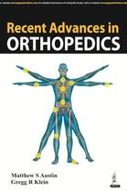 Recent Advances In Orthopedics
