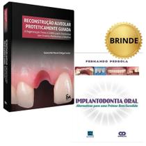 Reconstrução Alveolar Proteticamente Guiada - Guaracilei Maciel Vidigal Jr + Implantodontia Oral