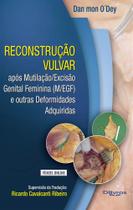 Reconstrucao vulvar com video - Dilivros Reconstrucao vulvar com video - Dilivros