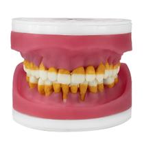 Refil De Cirurgia com Dentes de Periodontia AC 025 Pronew