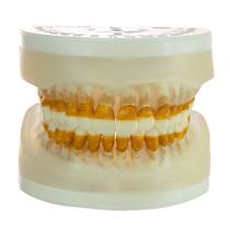 Refil de Periodontia I p/ Manequim Articulado AC 104 Pronew