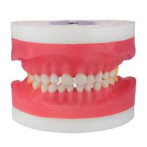 Refil Odontopediatria para Manequim Articulado AC 101 Pronew