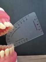 Régua para Medir Abertura Bucal, DTM, Bucomaxilofacial, Fisioterapia