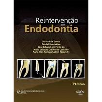Reintervenção em Endodontia - Quintessence Nacional