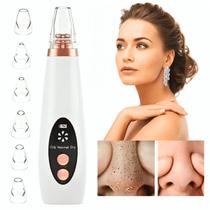 Removedor Cravos Espinha Máquina Peeling Sugador Pele Rose