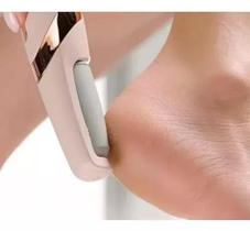 Removedor De Calos Elétrico Removedor De Calos Elétrico