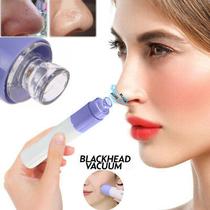 Removedor de Cravos a Vácuo Peeling Facial Esfoliação Profunda Rosto Macio Sem Impurezas Promoção Removedor de Cravos a Vácuo Peeling Facial Esfoliação Profunda Rosto Macio Sem Impurezas Promoção
