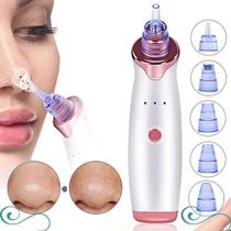 Removedor De Cravos Espinhas Poros Do Rosto Elétrico Removedor De Cravos Espinhas Poros Do Rosto Elétrico