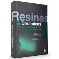Resinas E Cerâmicas Protocolos Com Aplicação Clínica Para Dentes Anteriores E Posteriores