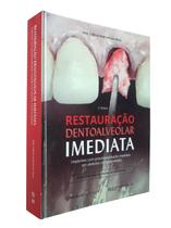 Restauração dentoalveolar imediata - implantes com provisionalização imediata em alvéolos comprometidos - Editora Napoleão Restauração dentoalveolar imediata - implantes com provisionalização imediata em alvéolos comprometidos - Editora Napoleão