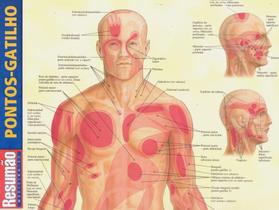 Resumão Medicina - 23 - Pontos-Gatilho - Barros Fischer & Associados
