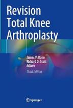 Revision total knee arthroplasty