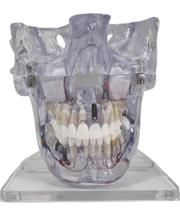 Ri-104 mandíbula/ maxila
