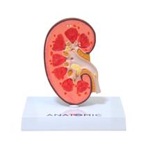 Rim Humano com Patologias Corte Mediano, Anatomia Rim Humano com Patologias Corte Mediano, Anatomia