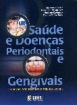 Saude e doencas periodontais e gengivais