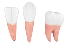 Sd-5059/h - dente em 6 partes (incisivo, canino e molar)
