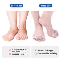 Separador De Silicone Para Dedos Pés -calos