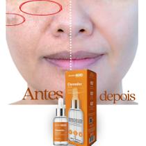 Sérum Clareador de Melasma Dermachem Com Ácido Mandélico Niacinamida Clareia Manchas 30 Ml