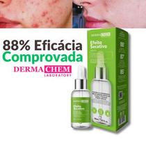 Sérum Efeito Secativo para Espinhas e Acnes Sérum Efeito Secativo para Espinhas e Acnes