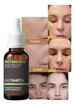 Serum Eficaz Retinol Com Vitamina C Redutor Rugas 30ml Sh.